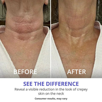 Neckcovery™ Tighten & Lift Neck Cream