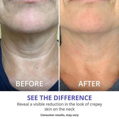 Neckcovery™ Tighten & Lift Neck Cream